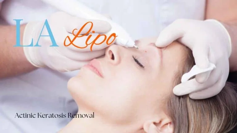 Woman receiving Actinic Keratosis Removal Treatment Norfolk