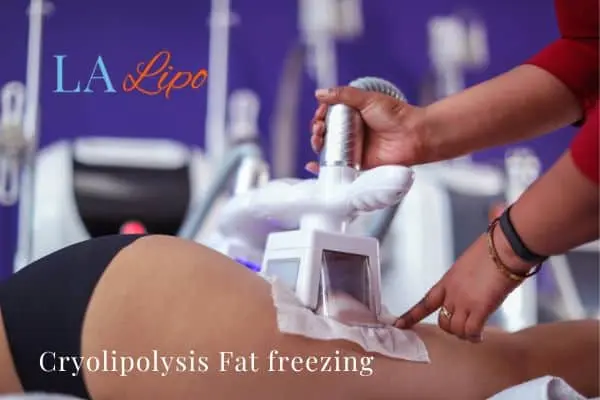 women getting fat freezing Norfolk