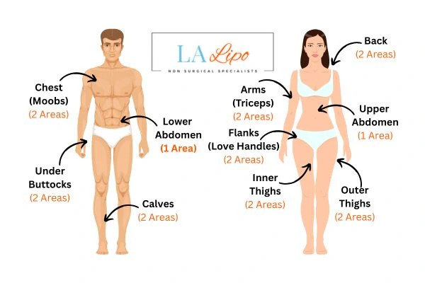 LA LIPO Cryolipolysis Areas Norfolk
