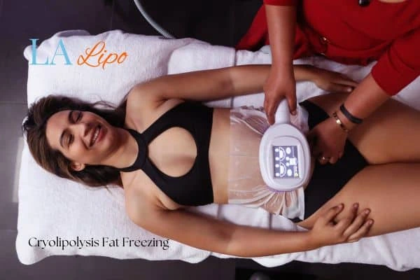 woman getting cryolipolysis Norfolk