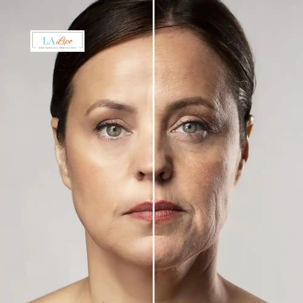 How Can You Tell If Non-Surgical Skin Tightening Is Right for You Norfolk?
