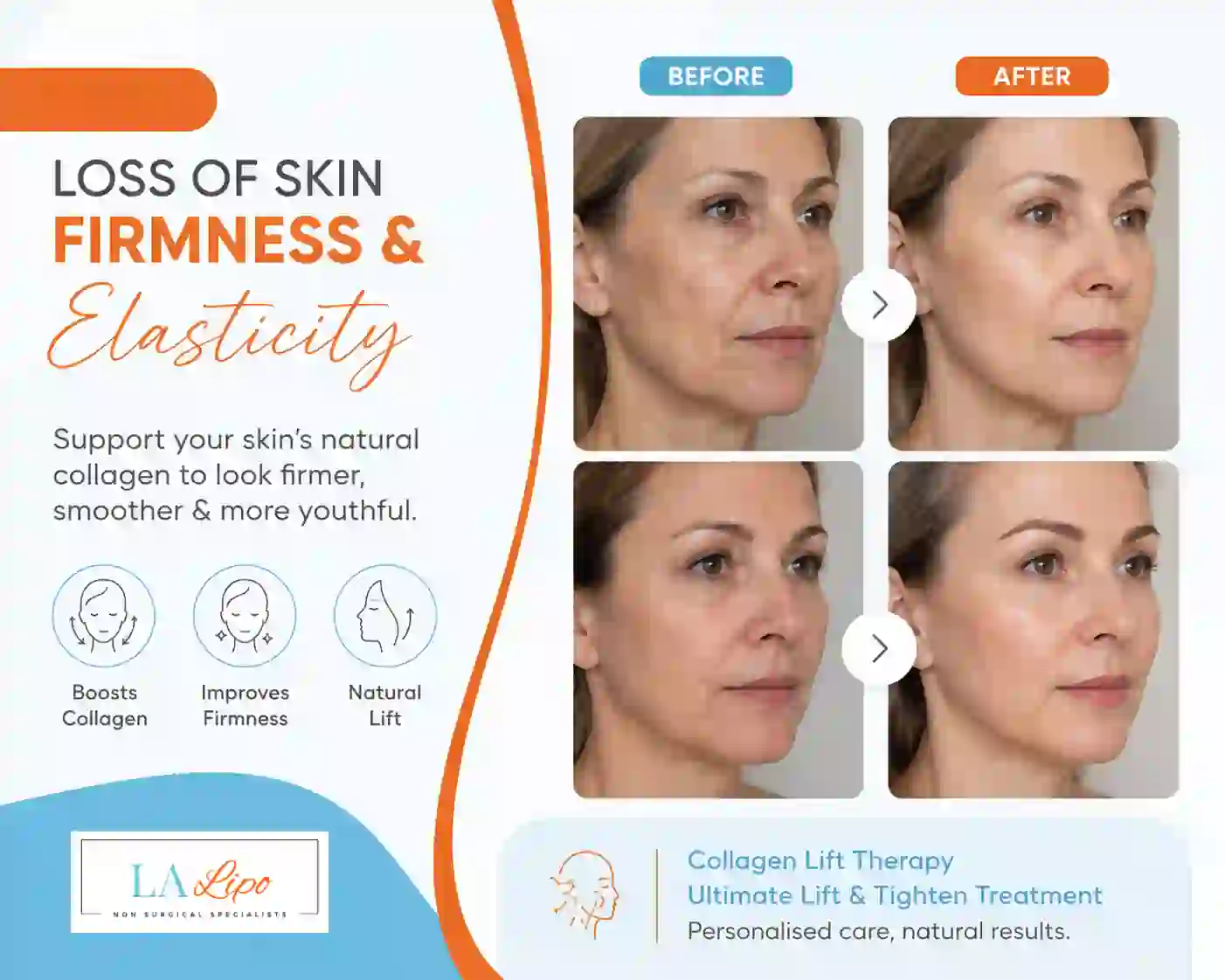 Sign #7: Loss of Skin Firmness and Elasticity Norfolk